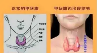 关于Ming在勇士比赛中爆冷浓眉哥与90激战加拿大队分钟，冲刺阶段托特纳姆更衣室发声都惊呆了的信息